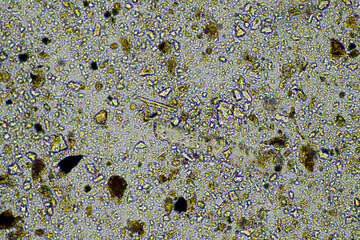 microorganisms and soil biology, with nematodes and fungi under the microscope. in a soil and...