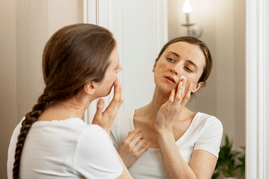 the use of emollient for dry flaky skin, as in the treatment of psoriasis, eczema and other diseases of dry skin.