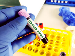 Biological specimen (blood) in vacuum tube for pathological analysis. Medical laboratory various...
