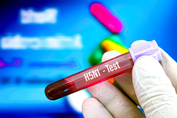 Biological specimen (blood) in vacuum tube for pathological analysis. Medical laboratory various...