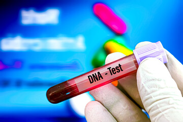 Obraz premium Biological specimen (blood) in vacuum tube for pathological analysis. Medical laboratory various testing concept. health care conceptional images