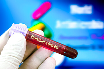 Biological specimen (blood) in vacuum tube for pathological analysis. Medical laboratory various...