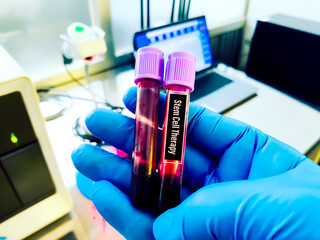 Biological specimen (blood) in vacuum tube for pathological analysis. Medical laboratory various...