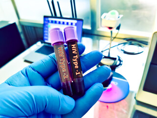 Biological specimen (blood) in vacuum tube for pathological analysis. Medical laboratory various...