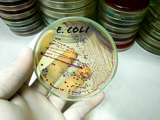 Medical technologist holds Bacteria culture growth on chromogenic media plate in Microbiology...