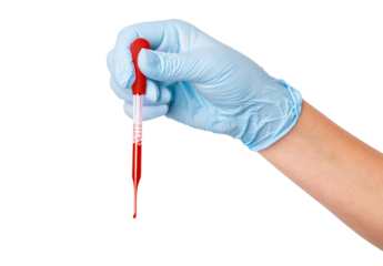 Hand in medical gloves holding a pipette with blood on an empty background. Laboratory testing, medical analysis, healthcare applications.