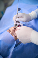 Doctor performs a polypotomy in a modern clinic