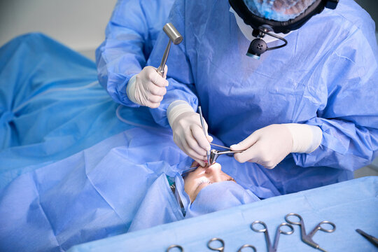 Modern operation to straighten a deviated nasal septum