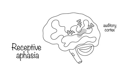 Receptive aphasia