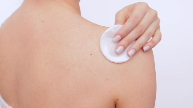 Young girl shows pimples on her skin on her back and shoulders.