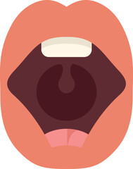 This illustration shows an open mouth with the tongue showing, teeth, and filling