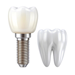 Isolated set of white teeth and dental implant on transparent background
