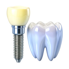 Isolated set of white teeth and dental implant on transparent background