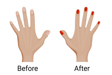 Fototapeta premium Before and after manicure vector illustration design.