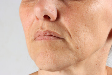 close-up on the wrinkles around the mouth of a 45-year-old woman , nasolabial folds