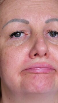 Portrait the fingers holding the flabbiness adipose sagging skin, Flabby skin and loose, swelling and ptosis beside the eyelid, dark spots and wrinkle on the face, health care and beauty concept.