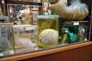 Internal organs. Fertile horn of uterus, cow brain, lizard and real human brain