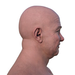 A man's hairless head from side view, 3D illustration