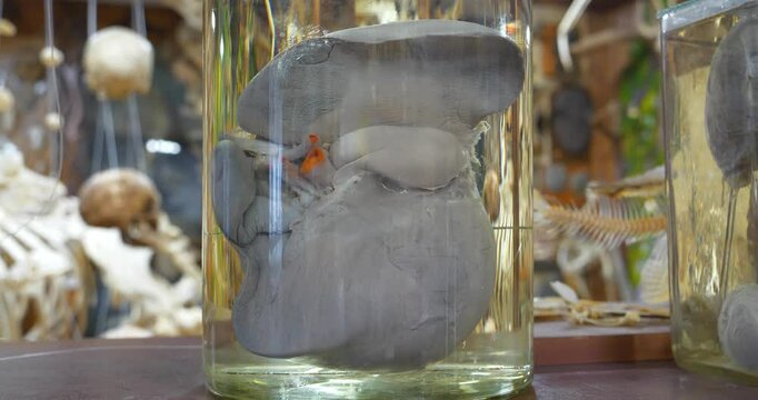 Human liver in glass flask. Major metabolic organ, which performs many essential biological functions such as detoxification of the organism, and the synthesis of proteins and biochemicals necessary