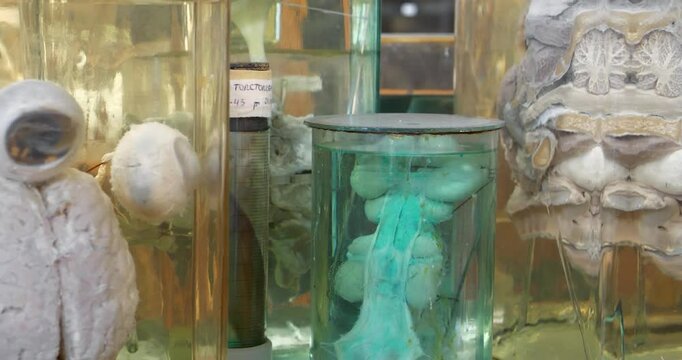 Animals internals in glass jars with formaldehyde for medical research, among which the reproductive system of rooster and sagittal section of calf head
