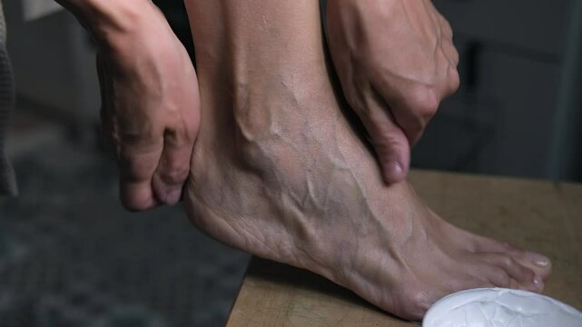 A mature woman is taking care of her legs. Rubs beautiful foot with veins cream. Foot care. Venous disease - varicose veins. 