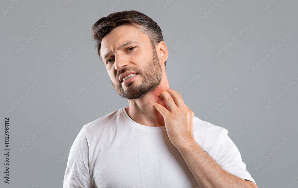 Wall mural middle aged bearded man scratching highlighted with red neck on grey studio background, copy space. 