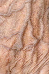 Visible veins on the hands of an old woman