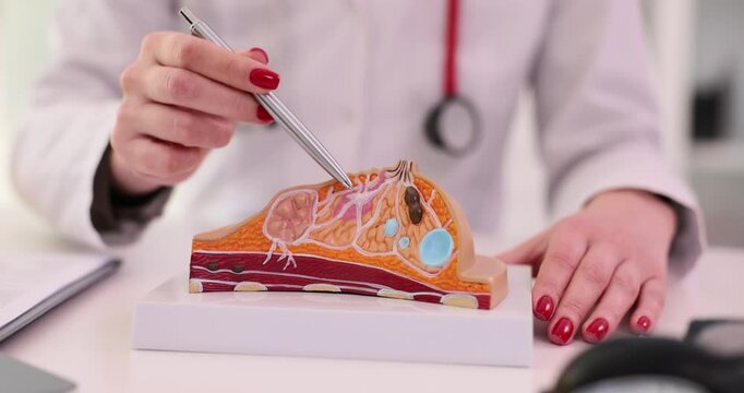Female doctor explaining disease of mammary glands using an anatomical model of breast. Diseases of mammary glands causes prevention and treatment