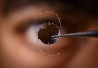 Close-up of intraocular lens held by tweezers with blurred eye in background