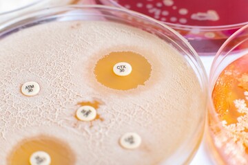 Antibiotic susceptibility test on agar plates