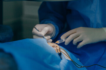 Eye surgery in a modern clinic. Vision correction	
