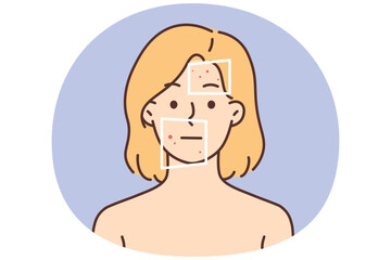 Woman with red pimples on face