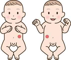 人工肛門、ストーマ、大腸、子供、こども、赤ちゃん、イラスト、illustration