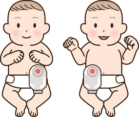 人工肛門、ストーマ、大腸、子供、こども、赤ちゃん、イラスト、illustration