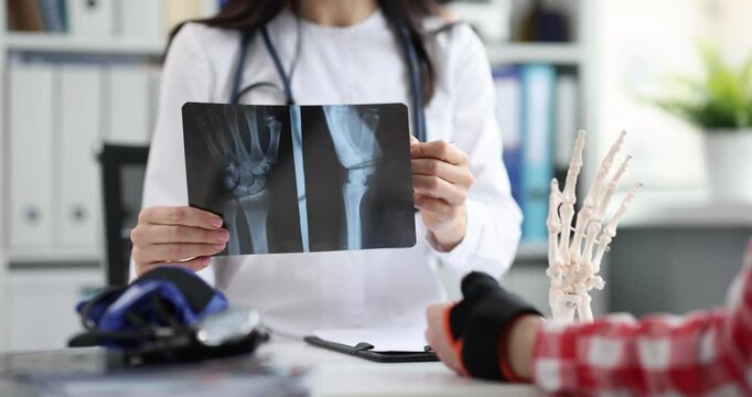 Traumatologist holds x-ray with fractured arm of patient. Injury fractures and surgery hand concept