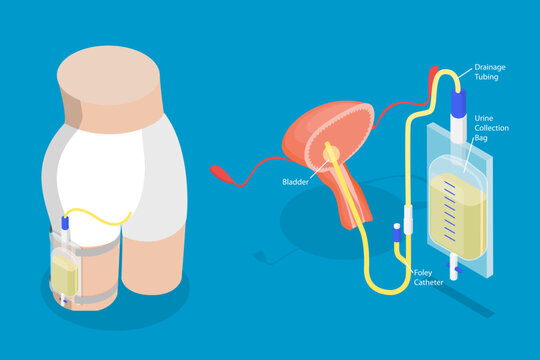 3D Isometric Flat Vector Illustration of Drainage Bladder, Flexible Rubber Urine Bag For Bladder Infections Treatment