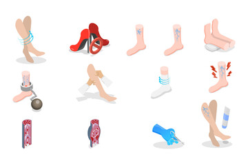 3D Isometric Flat  Set of Varicose Treatment, Health Care