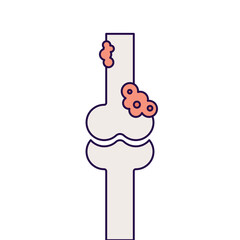 bone cancer disease