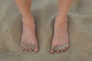 Female bare feet standing on sand, both feet wearing silicone toe separators to promote healthy toe alignment and foot care.