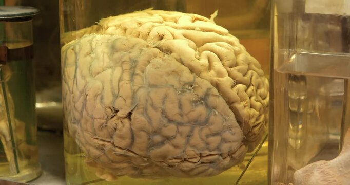 Real human brain. Anatomy of brain, grey substance, grey matter, cortical grey. Human brain in glass jar with formaldehyde for medical research. Brain in a vat. Cinema 4K 60fps zoom-out video