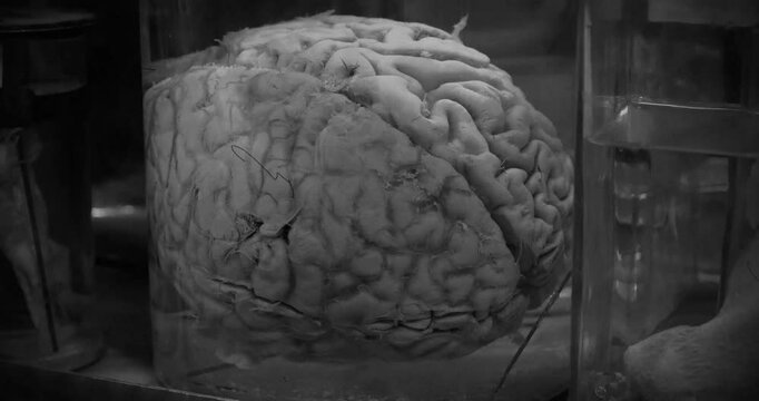 Anatomy of brain. Human brain in glass jar with formaldehyde for medical research. Human brain in a flask. Brain in a vat. 4K video in retro style with cinema effects, old filming