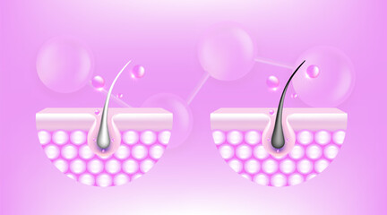 Hyaluronic acid and Niacinamide before and after gray hair and skin solutions ad, pink collagen serum drops into skin cell with cosmetic advertising background ready to use, illustration vector.