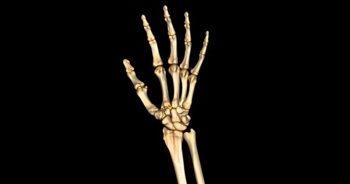 CT scan footage showing a detailed 3D rendering of a normal human hand. The scan highlights clear bone structures, joints, and soft tissues.