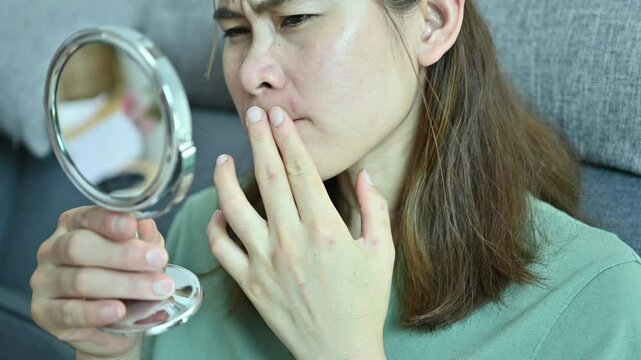 Asian woman worried about her face when she saw acne and freckles occur on her face by mini mirror. Allergies, irritants, genetic makeup, etc can cause skin conditions.