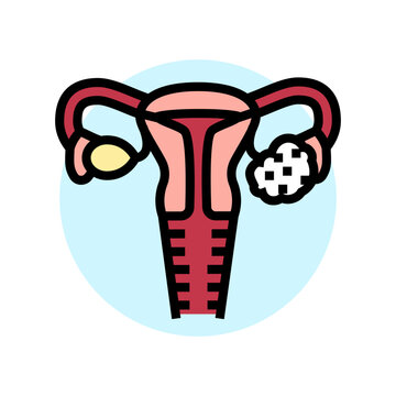 polycystic ovary syndrome woman disease color icon vector. polycystic ovary syndrome woman disease sign. isolated symbol illustration