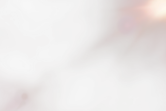 Radiant Flare Rays and Solar Flares with Sparkling Starburst Overlay Isolated on Transparent Background for Glowing Light Effect