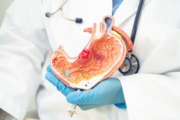 Stomach disease, doctor holding anatomy model for study diagnosis and treatment in hospital.
