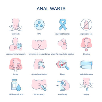 Anal Warts symptoms, diagnostic and treatment vector icons. Medical icons.