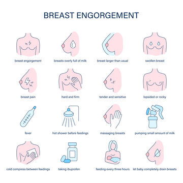 Breast Engorgement symptoms, diagnostic and treatment vector icons. Medical icons.