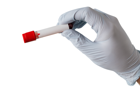 Doctor holding a blood test tube during coronavirus pandemic transparent png